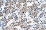 DLX5 Antibody in Immunohistochemistry (IHC)