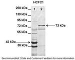 HCFC1 Antibody in Western Blot (WB)