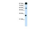 CTCF Antibody in Western Blot (WB)