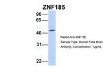 ZNF185 Antibody in Western Blot (WB)