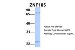 ZNF185 Antibody in Western Blot (WB)