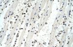 TRIM32 Antibody in Immunohistochemistry (IHC)