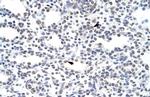 ILF3 Antibody in Immunohistochemistry (Paraffin) (IHC (P))