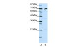 ILF3 Antibody in Western Blot (WB)