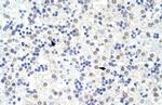 SART3 Antibody in Immunohistochemistry (IHC)