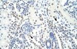 POGZ Antibody in Immunohistochemistry (IHC)