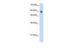 RCOR1 Antibody in Western Blot (WB)