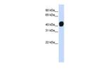 HIC5 Antibody in Western Blot (WB)