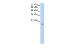 ZNF580 Antibody in Western Blot (WB)