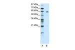 ZNF312 Antibody in Western Blot (WB)