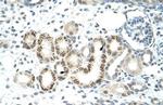 JMJD2D Antibody in Immunohistochemistry (IHC)