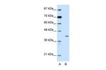 HMBOX1 Antibody in Western Blot (WB)