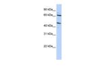 SLC26A10 Antibody in Western Blot (WB)