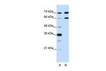 DMRT2 Antibody in Western Blot (WB)