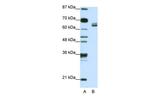 ZFP57 Antibody in Western Blot (WB)