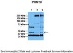 PRMT8 Antibody in Western Blot (WB)