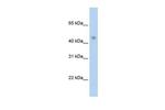 PRMT8 Antibody in Western Blot (WB)