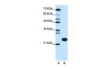 RPL13 Antibody in Western Blot (WB)