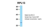 RPL13 Antibody in Western Blot (WB)