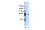 EXOSC3 Antibody in Western Blot (WB)