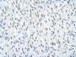 SF3B1 Antibody in Immunohistochemistry (Paraffin) (IHC (P))