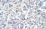 SF3B1 Antibody in Immunohistochemistry (Paraffin) (IHC (P))