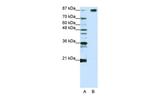 SF3B1 Antibody in Western Blot (WB)