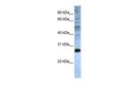 eIF4E Antibody in Western Blot (WB)