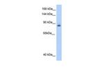 Aconitase 1 Antibody in Western Blot (WB)