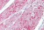 OAS1 Antibody in Immunohistochemistry (IHC)