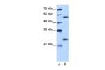 CPNE1 Antibody in Western Blot (WB)