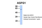 AGFG1 Antibody in Western Blot (WB)