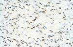 ILF3 Antibody in Immunohistochemistry (Paraffin) (IHC (P))