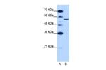 ZRSR2 Antibody in Western Blot (WB)