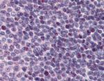 PCBP1 Antibody in Immunohistochemistry (Paraffin) (IHC (P))