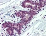 PCBP1 Antibody in Immunohistochemistry (Paraffin) (IHC (P))