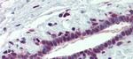 PCBP1 Antibody in Immunohistochemistry (Paraffin) (IHC (P))