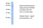 NOP56 Antibody in Western Blot (WB)