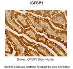 IGF2BP1 Antibody in Immunohistochemistry (IHC)