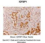 IGF2BP1 Antibody in Immunohistochemistry (IHC)