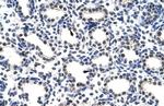 POP4 Antibody in Immunohistochemistry (Paraffin) (IHC (P))