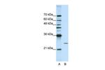 POP4 Antibody in Western Blot (WB)