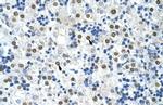 HNRNPA0 Antibody in Immunohistochemistry (Paraffin) (IHC (P))