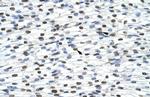 HNRNPA0 Antibody in Immunohistochemistry (Paraffin) (IHC (P))