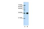 HNRNPA0 Antibody in Western Blot (WB)