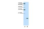 SNRPD1 Antibody in Western Blot (WB)