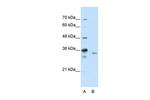 EXOSC3 Antibody in Western Blot (WB)