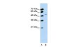 RBM22 Antibody in Western Blot (WB)