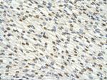 DAZAP1 Antibody in Immunohistochemistry (Paraffin) (IHC (P))