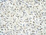 DAZAP1 Antibody in Immunohistochemistry (Paraffin) (IHC (P))